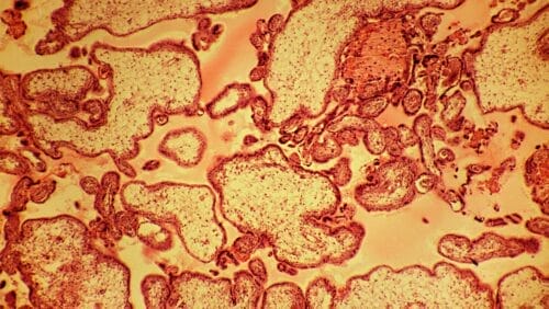 microscopic view of placental tissue
