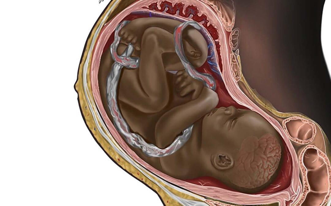 The Creator of a Viral Black Fetus Medical Illustration Blends Art and Activism